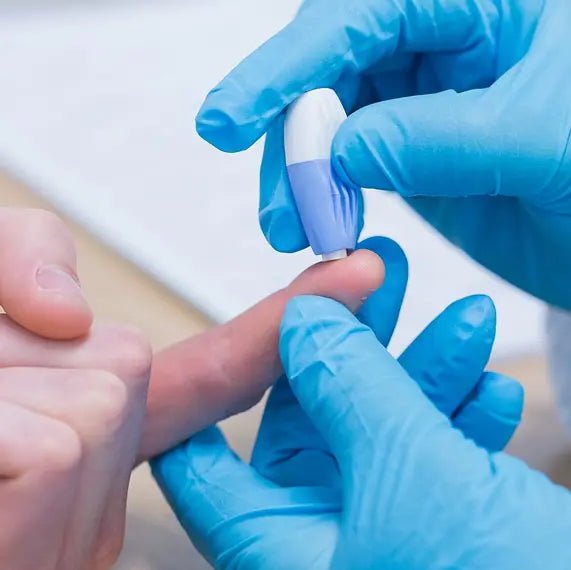 FoodPrint Indicator Food Intolerance Test including Results Analysis &amp; Consultation by Nature's Balance